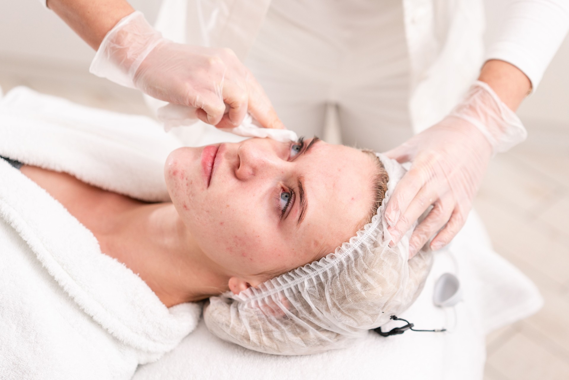 The doctor removes the gel from the patients face and apply a therapeutic cream. Anti acne phototherapy. Beautiful woman during photo rejuvenation procedure. Face skin treatment at cosmetic clinic.